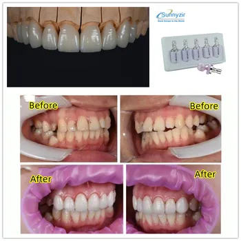 Sunnyzir 5шт Стеклокерамические Блоки из Дисиликата лития C14 LT Dental Lab Emax Материал для Фрезерной системы CAD CAM Sirona Cerec 13
